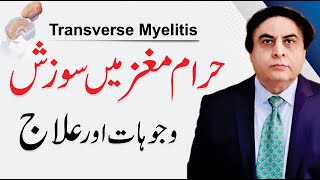 Transverse Myelitis Symptoms  حرام مغز میں سوزش  ISpinal Cord ka Ilaj by Dr Khalid Jamil [upl. by Loggins244]