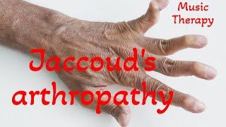 Jaccouds arthropathy  Music Therapy [upl. by Odessa]