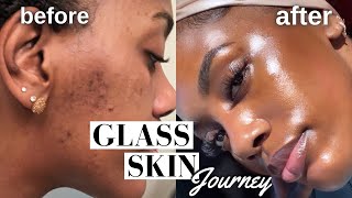 HOW I CLEARED MY HYPERPIGMENTATION ACNE AND DARK SPOTS  GLASS SKIN ROUTINE MUST WATCH [upl. by Ailaroc]