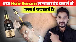 Kya Redensyl Hair Serum लगाना बंद करने से वापस से Hair Fall होता है Genuine Tips [upl. by Eca318]