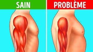 Dégénérescence Musculaire  N’ignore Pas Ces 8 Symptômes Précoces [upl. by Orips]