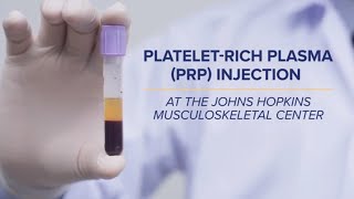 PlateletRich Plasma PRP Injections  QampA [upl. by Robb]