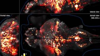 Wholebrain Imaging of Neuronal Activity with Cellular Resolution [upl. by Sommer305]