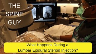 What Happens During a Lumbar Epidural Steroid Injection [upl. by Hoxsie]