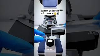 Sperm under the microscope 😦 🔬viralvideo microscope shortfeed animals shorts reels [upl. by Artsa]