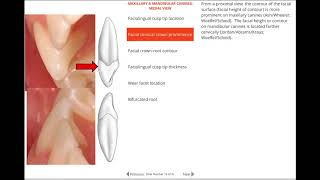 Comparison Between Permanent Maxillary And Mandibular Canine [upl. by Ayyidas895]