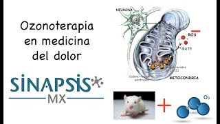 ¿Qué es la ozonoterapia [upl. by Eriuqs]