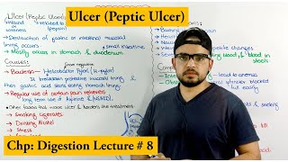 Ulcer Disease peptic ulcer  Causes symptoms and Treatments [upl. by Acino]