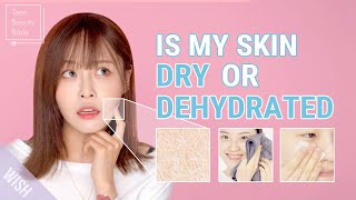 You Have Dry Skin amp ACNE Best Skincare for Dry vs Dehydrated Skin l You Need to See This [upl. by Josy910]