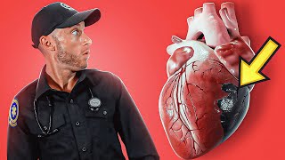 CARDIOGENIC SHOCK Explained In Under 6 Minutes [upl. by French]