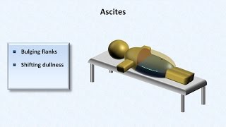 Cirrhosis  Physical Findings [upl. by Aneeuq]