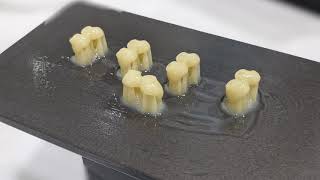 Semiimmediate 3dprinted provisional implant crowns on Tri Matrix implants [upl. by Bertelli]