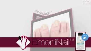 EmoniNail Toenail Fungus Treatment  Video Review [upl. by Ahseid]