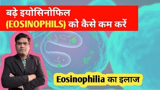 Eosinophilia का इलाज  Treatment of High Eosinophil in Blood [upl. by Cela]