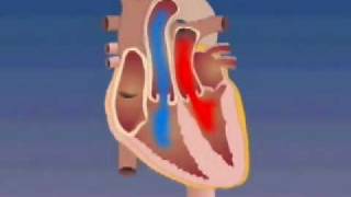 Transposition of the Great Arteries [upl. by Zerlina]