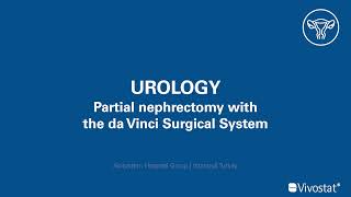 Vivostat Fibrin used for partial nephrectomy with the da Vinci Surgical System [upl. by Sirk]