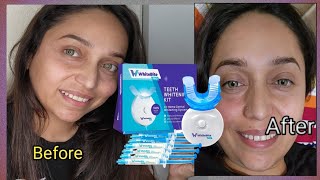 white bite pro teeth whitening kit for sensative teeth with LED light 35 carbamide peroxide [upl. by Koral288]