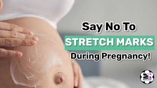 7 Tips To Prevent Stretch Marks During Pregnancy  Pregnancy Healthy Tips [upl. by Arod]