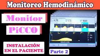 MONITOREO HEMODINAMICO  SISTEMA PICCO  COLOCACIÓN EN EL PACIENTE PARTE 23 [upl. by Mikael967]