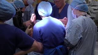 Having a forceps delivery  Understanding Shoulder Dystocia  One Born Every Minute [upl. by Christiansen730]