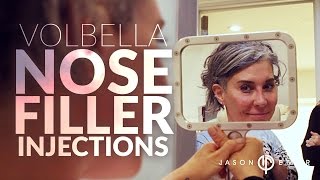 Nose Job Without Surgery With Volbella Filler amp Syringe  Nose Reshaping  Dr Jason Emer [upl. by Alleinad307]