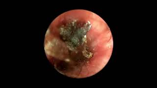 Ear Mites Inside Dog’s Ear Canal Video Otoscopy [upl. by Naghem]