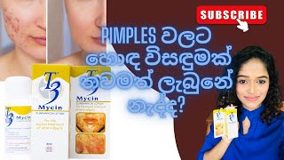 Pimples වලට හොඳ විසඳුමක් තවමත් ලැබුනේ නැද්දT3 Mycin CLINDAMYCIN LOTIONnithyabeautypointt3 [upl. by Stretch18]