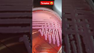 klebsiella bacteria 🦠🧫shorts youtubeshorts labtechnologist medicallabtechnician [upl. by Solrac]