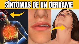 7 SÍNTOMAS de un ACV Derrame Cerebral antes de que OCURRA [upl. by Akirehc]