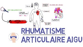 Rhumatisme articulaire aigu RAAde A à Z [upl. by Weisman]