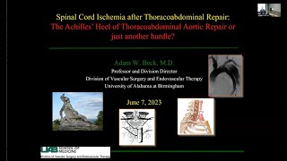 “Spinal Cord Ischemia The Achilles’ Heel of Thoracoabdominal Aortic Repair or Just Another Hurdle” [upl. by Annawot557]