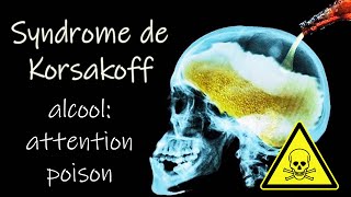 Les dangers de lalcool sur le cerveau syndrome de Wernicke Korsakoff un témoignage [upl. by Nyladnar779]