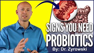 Probiotic Benefits  Top Signs You Should Be Taking A Probiotics [upl. by Hylan]