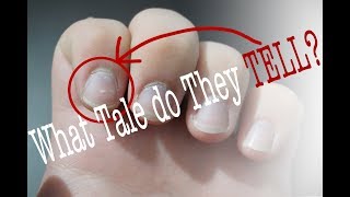 A Study in Fingernails Day to Day Deductions Docuvlog 1 [upl. by Ahsiner]