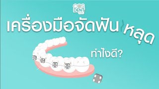 เหล็กจัดฟันหลุดกระทันหัน ต้องทำยังไง  COSDENT SMILE DESIGN [upl. by Ezekiel]