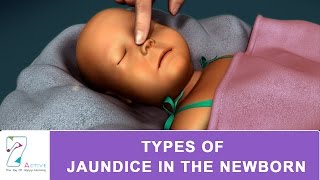 Types of Jaundice in Newborn [upl. by Akilam]