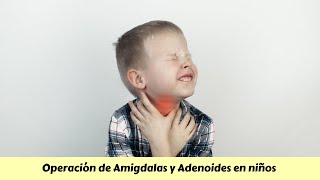 Operación de AMIGDALAS y adenoides en niños [upl. by Tnerb]