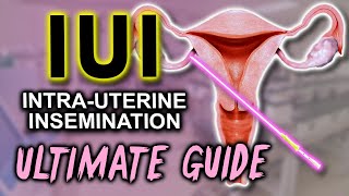 IUI  Fertility expert secrets for maximum pregnancy rates [upl. by Chui]