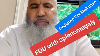 Prolonged fever with splenomegaly [upl. by Addis]