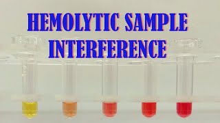 HEMOLYTIC SAMPLE INTERFERENCE [upl. by Fadil]