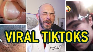 Dermatologists JawDropping Reaction to Amazing Pimple Pops [upl. by Alauqahs527]