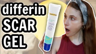 Applying Moisturizer After Differin Gel [upl. by Notnirt]