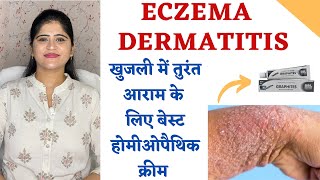 Best Homeopathic cream for Eczema and Dematitis ॥ खुजली में तुरंत आराम Gives instant Relief [upl. by Surat]