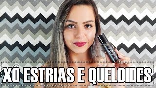 RESENHA CREME TOE XÔ ESTRIAS E QUELOIDES  💛Lorena Rodrigues💛 [upl. by Uttasta]