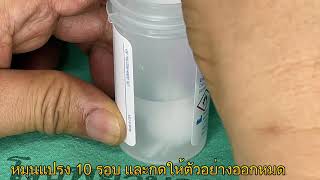 การเก็บตัวอย่างปากมดลูกโดยเจ้าหน้าที่เพื่อส่งตรวจ HPV DNA Test ProviderCollectd Cervical Sampling [upl. by Batsheva]