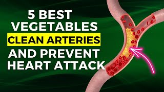 5 Best Vegetables To Clean Arteries And Prevent Heart Attacks [upl. by Mamie358]