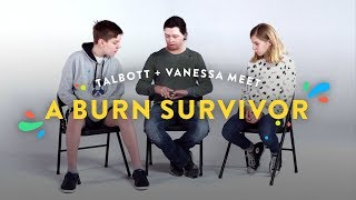 Kids Meet A Burn Survivor Talbott amp Vanessa  Kids Meet  HiHo Kids [upl. by Vittorio812]