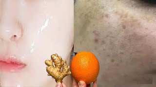 Ultimate Guide Best AntiAging Cream for Pigmentation amp Brightening  មុខសលឿនបាត់ជាំ  Fast Results [upl. by Artied1]