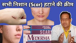 mederma cream  Mederma for acne scars  Mederma Advanced scar gel review [upl. by Yeh]