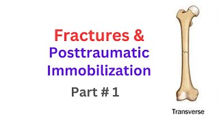 Fractures amp Posttraumatic Immobilization Chapter11 Therapeutics  Part 1 [upl. by Hummel]